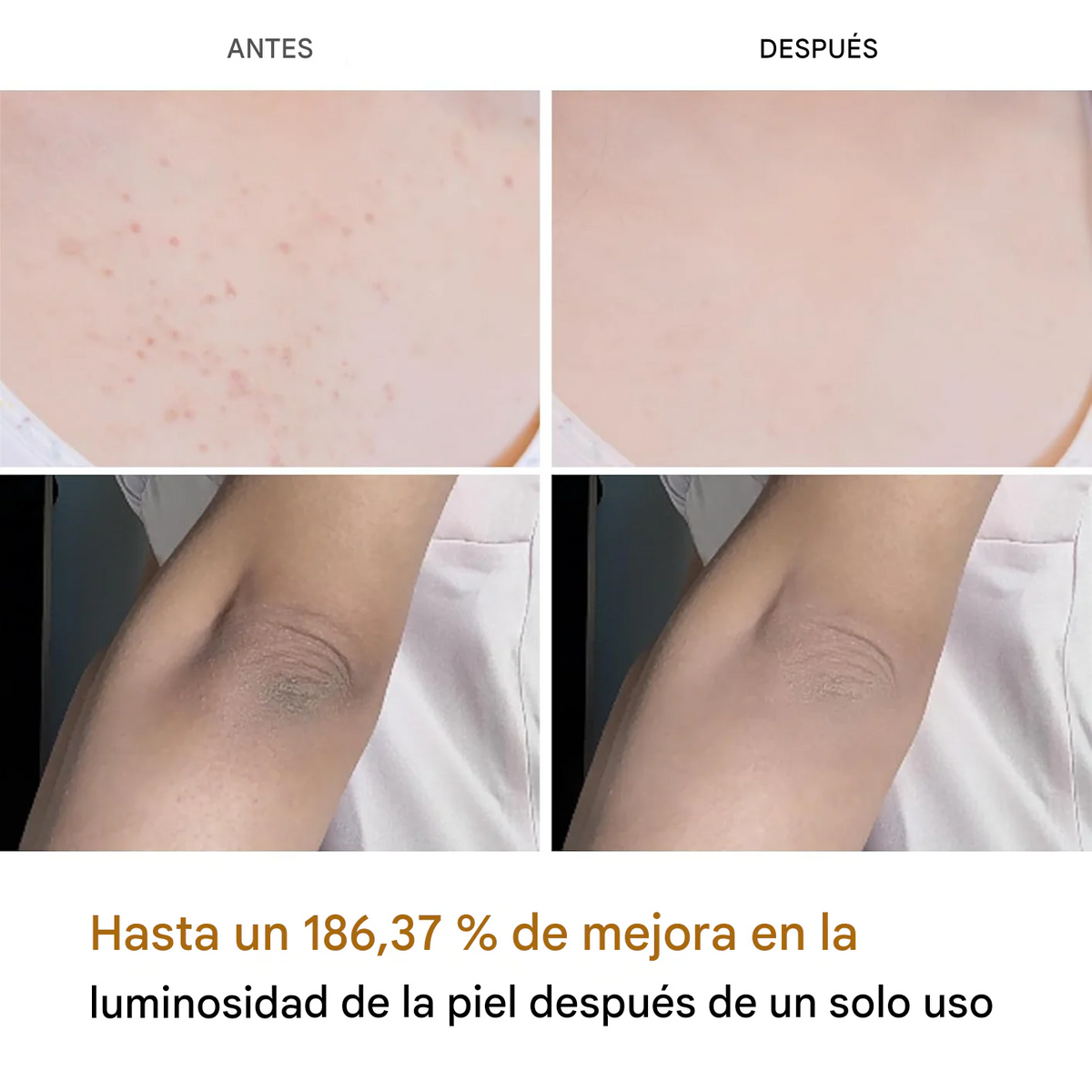 Dr.Melaxin™ PEEL SHOT SPRAY · ÁCIDO KÓJICO + CÚRCUMA · 200 ML